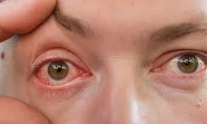 Hole in Retina Treatment Isha Netralaya, Thane ... main image