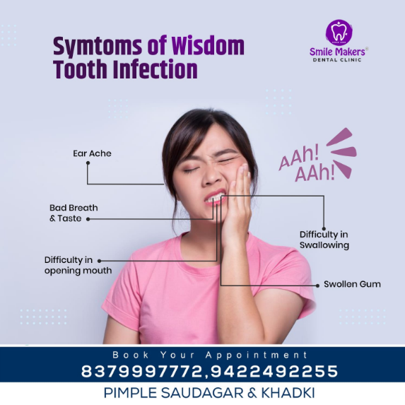 Did you know?
Wisdom teeth are the last molars ... main image