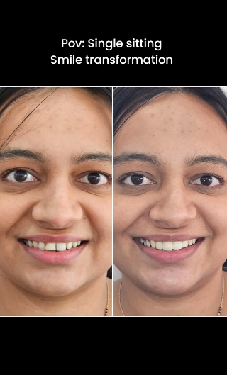 Top Dental Clinic in Pimple Saudagar | Dental C... main image