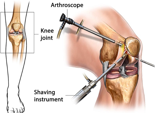 Comprehensive Arthroscopy Services at KC Hospit... main image