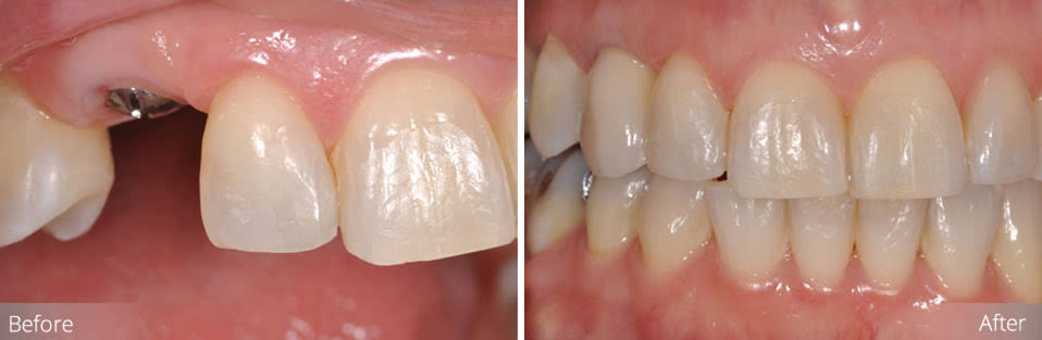 💫At Paras Dental Care, we offer a variety of ef... main image