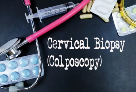 Colposcopy : A colposcopy is a diagnostic ... main image