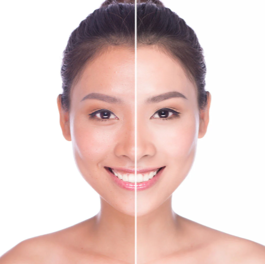 Skin Brightening Treatment in Bishop Garden and R.... main image