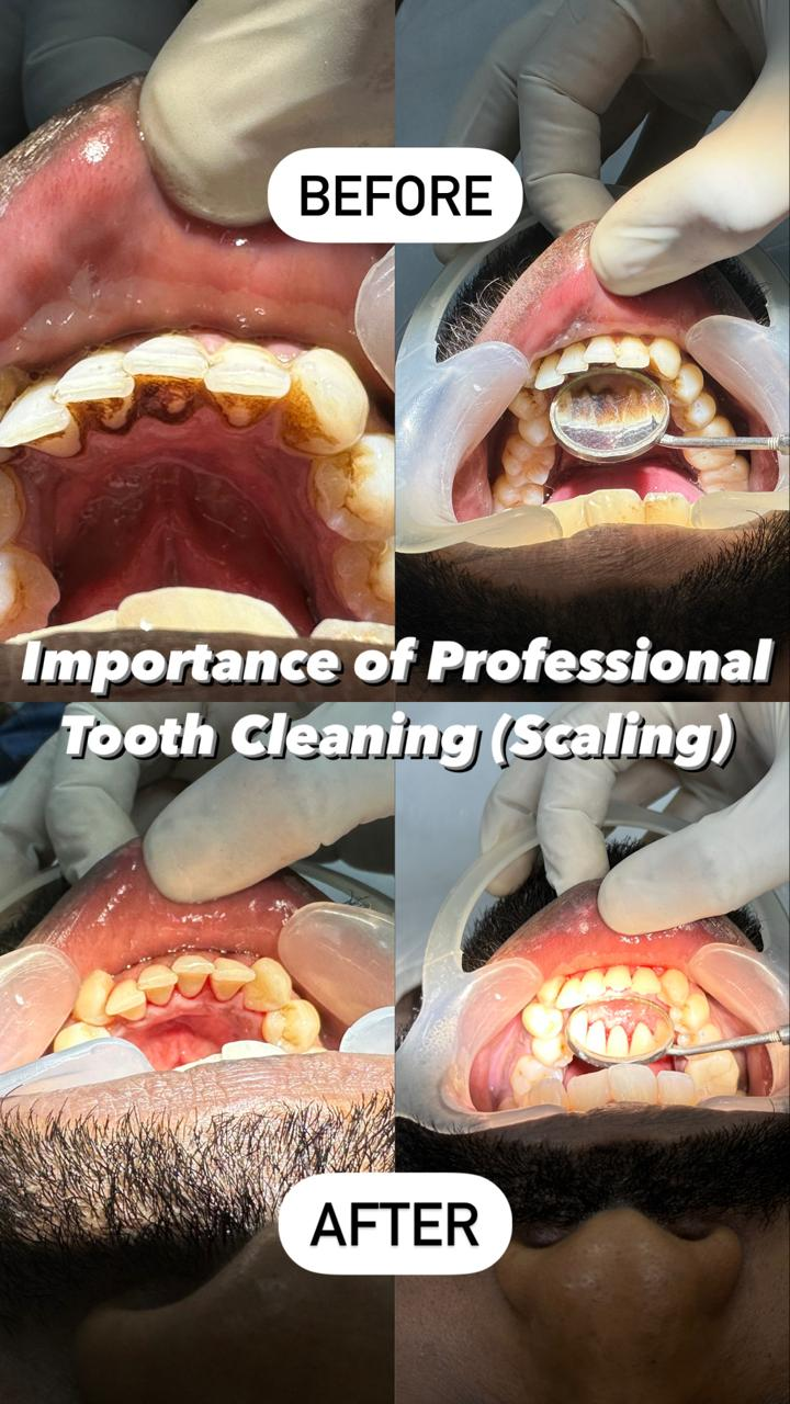 Best Dental Clinic in Manapakkam

MYTH : 
1. Te... main image