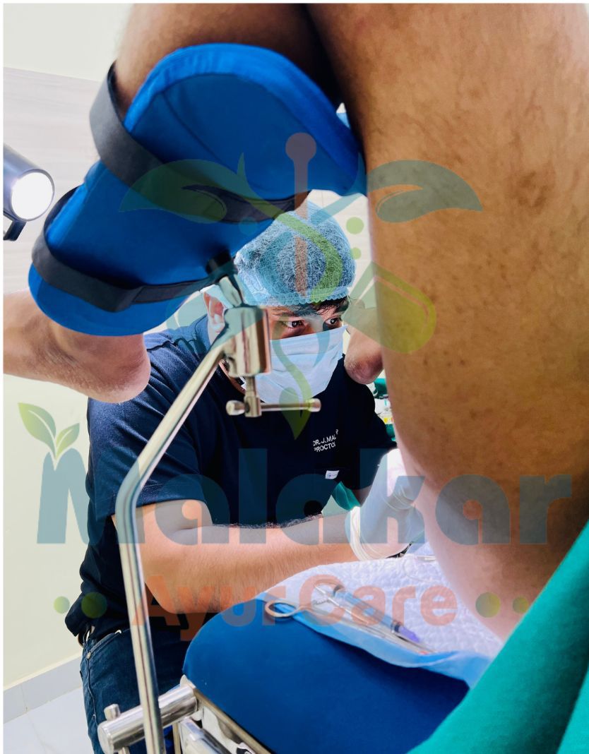 fistula treatment in tennur
Malakar Ayur Care offe... main image