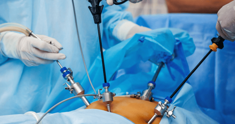 Expert Laparoscopic Surgery for Faster Recovery... main image