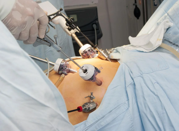 Keyhole Surgery Specialist in Mira Road: Minima... main image
