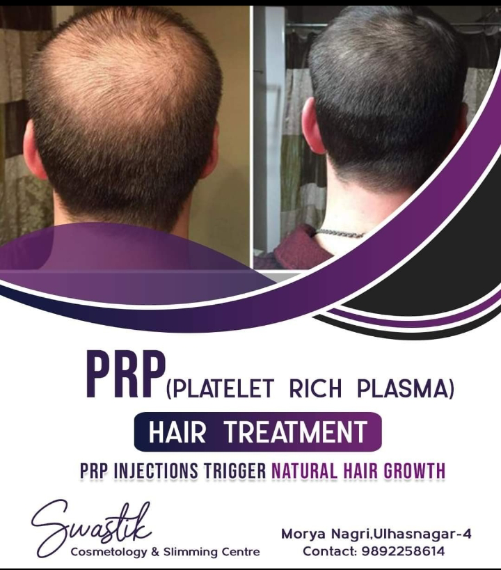 # Best PRP Treatment in Ulhasnagar 
# Prp Treatmen... main image
