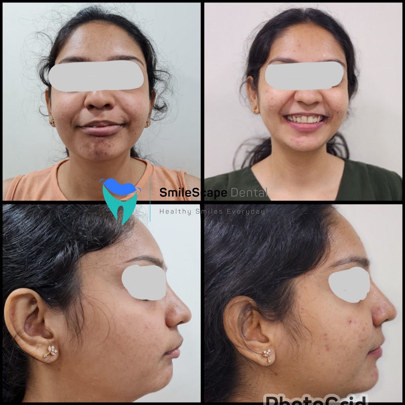 ORTHODONTIC TREATMENT and SMILE DESIGNING are p... main image