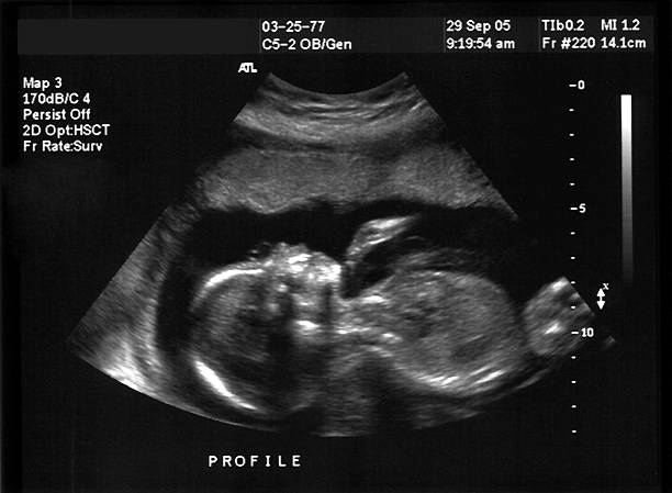 Ultrasound Services for Accurate Health Diagnos... main image