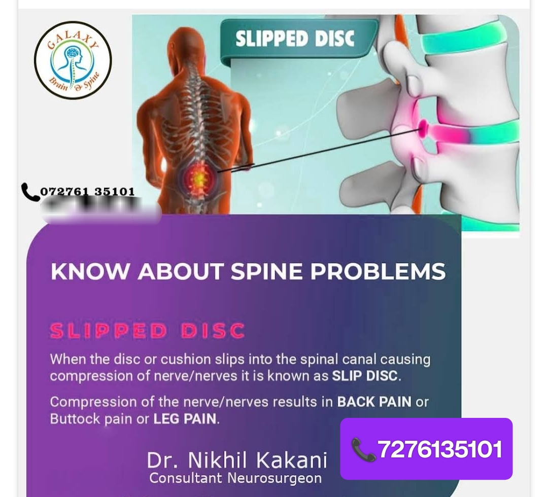 #DrNikhilKakaniNeurosurgeonSpinesurgeonNagpur
#Bes... main image