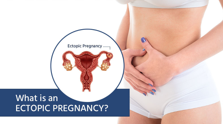 Ectopic Pregnancy Treatment in Nagpur Ectopic p... main image
