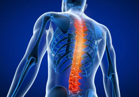 Spine Surgery to Restore Function and Reduce Pa... main image