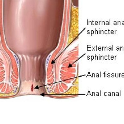 Anterior And Posterior Fissure