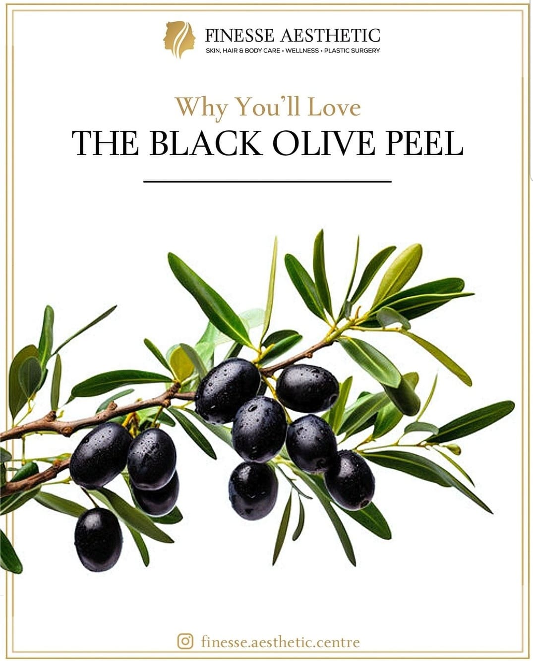 Why You Will Love Our Black Olive Peel at Finesse ... main image