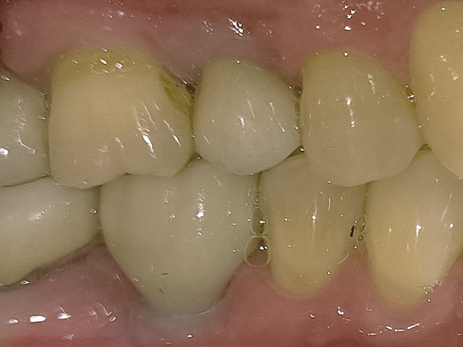 update image