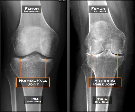Physiotherapy clinic in Tambaram
Are you Looking f... main image
