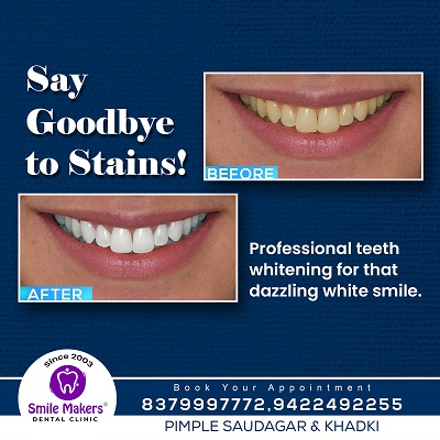 Say Goodbye to stains!!

Book your consultation... main image