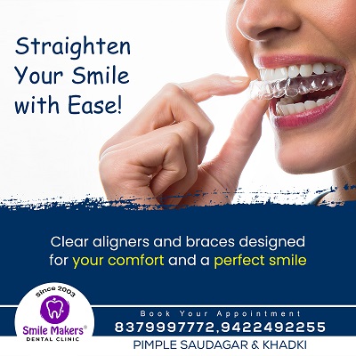 Best Dental Clinic in Pimple Saudagar |

Streng... main image