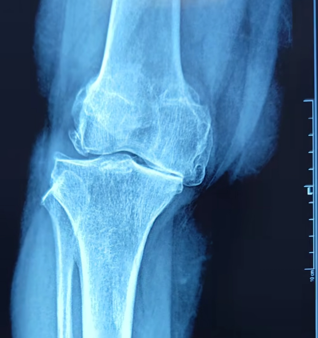Physiotherapy clinic in Tambaram
Are you Looking f... main image