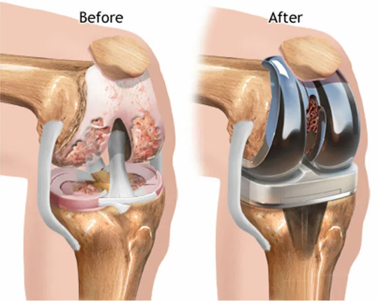 # Best Orthopedic Surgeon in Kalyan West 
#Top Ort... main image