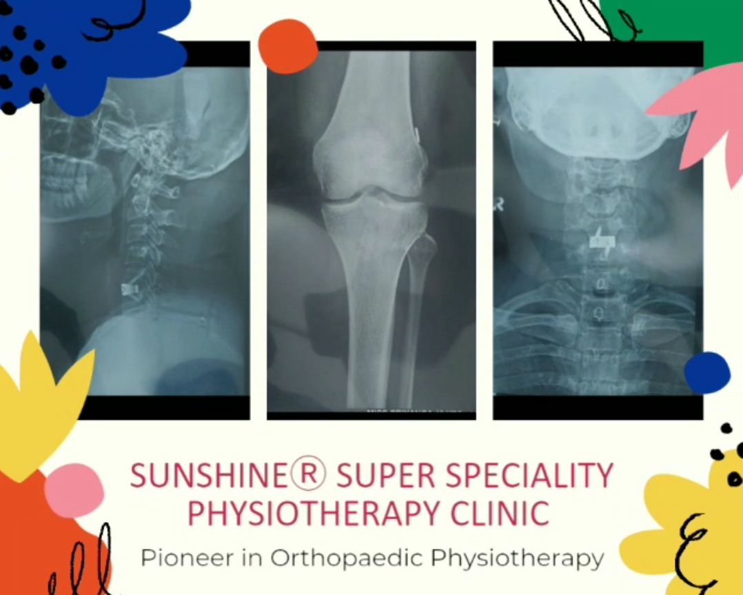 Physiotherapy clinic in Tambaram
Are you Looking f... main image