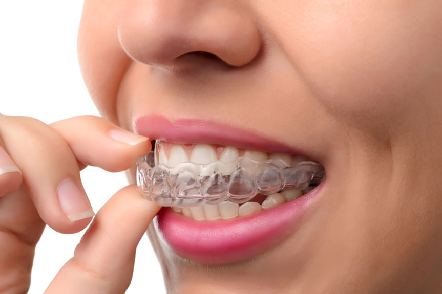 Paras Dental Care
Best Orthodontist for Invisal... main image