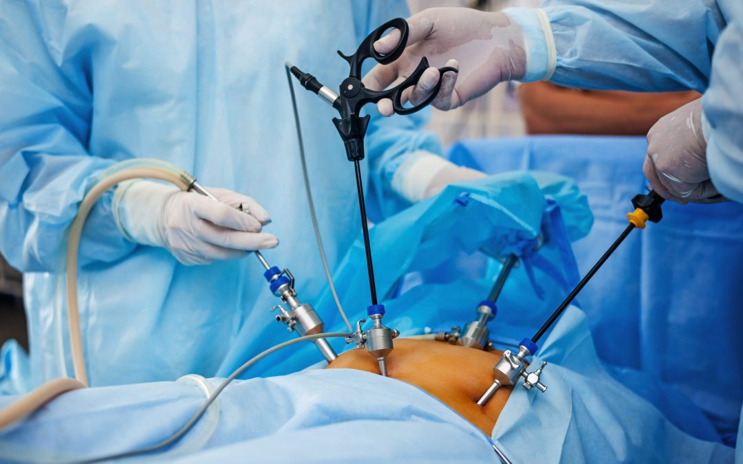 Laparoscopic Surgery: A Minimally Invasive Opti... main image