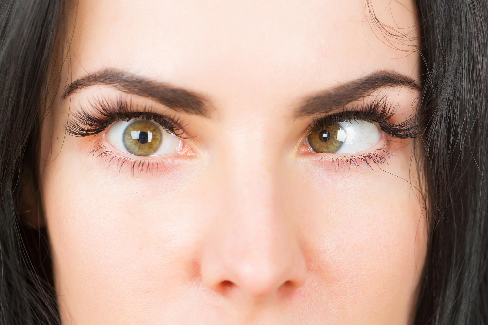 Squint Correction in Nagpur: Improving Eye Alig... main image