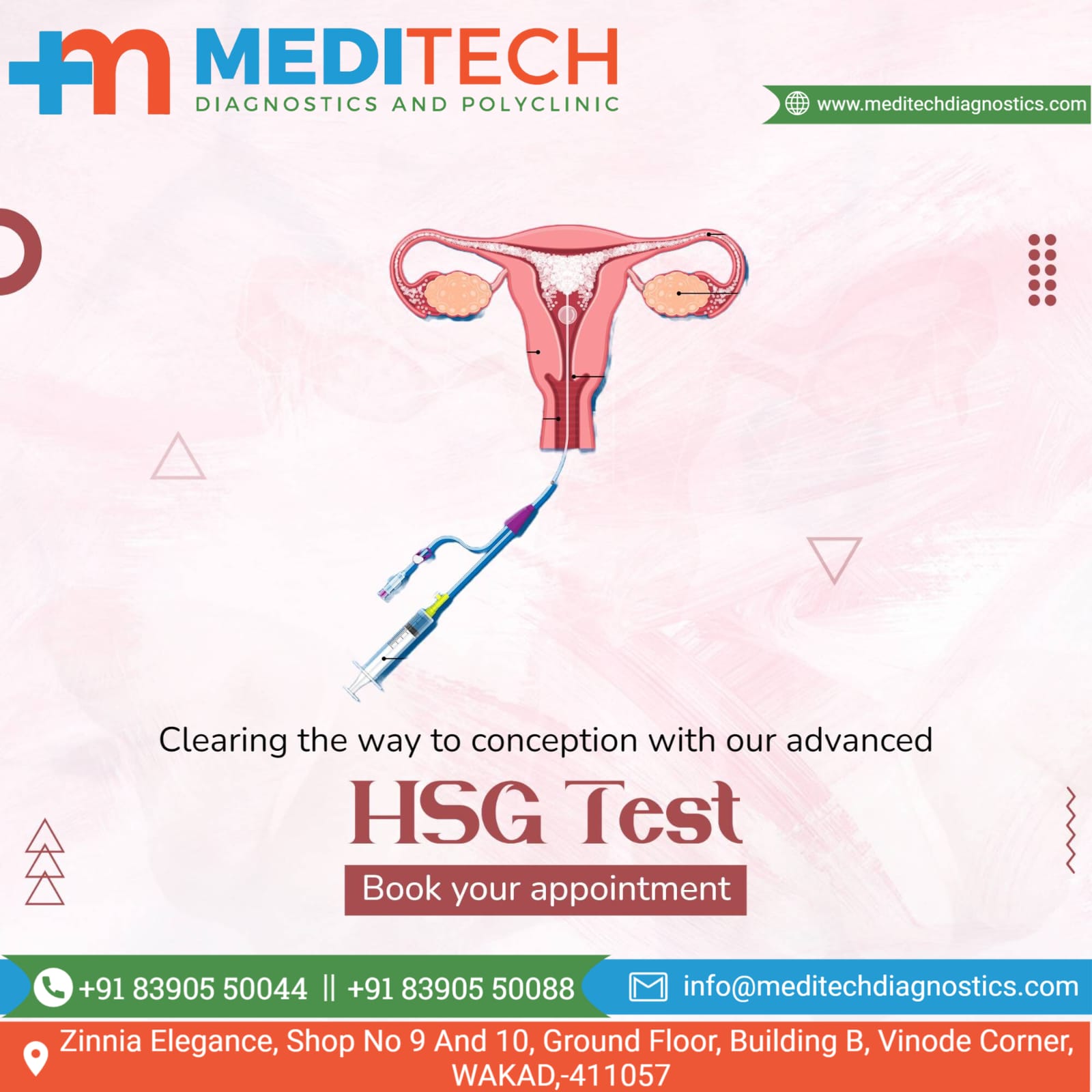 Hysterosalpingography (HSG), also known as uter... main image