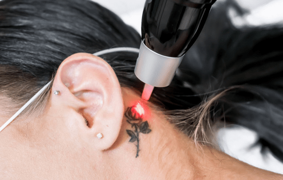 # Best Tattoo Removal In Ulhasnagar 
# Top Tattoo ... main image