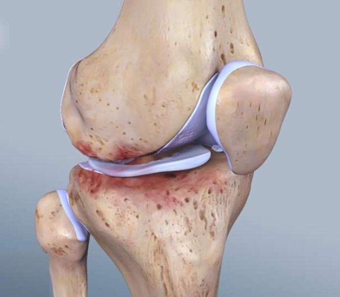 Physiotherapy clinic in Tambaram
Are you Looking f... main image