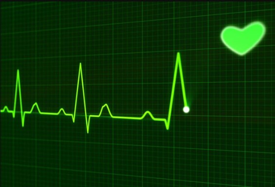 ECG (Electrocardiogr