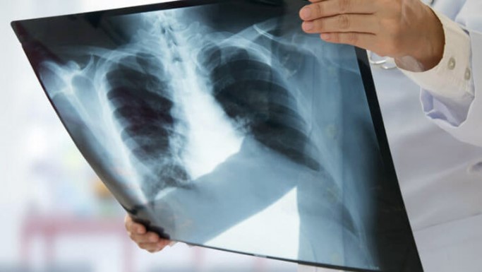 Digital X-ray servic