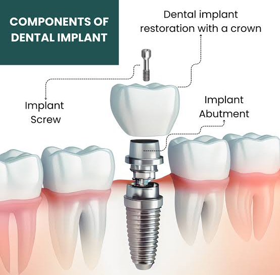 🦷 Smile Brighter with Paras Dental Care! 😁

Lookin... main image