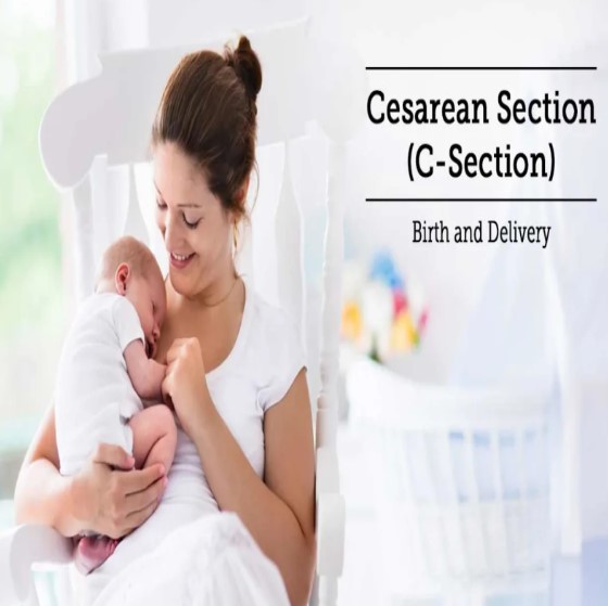 Cesarean Delivery: Safe and Supportive Options ... main image