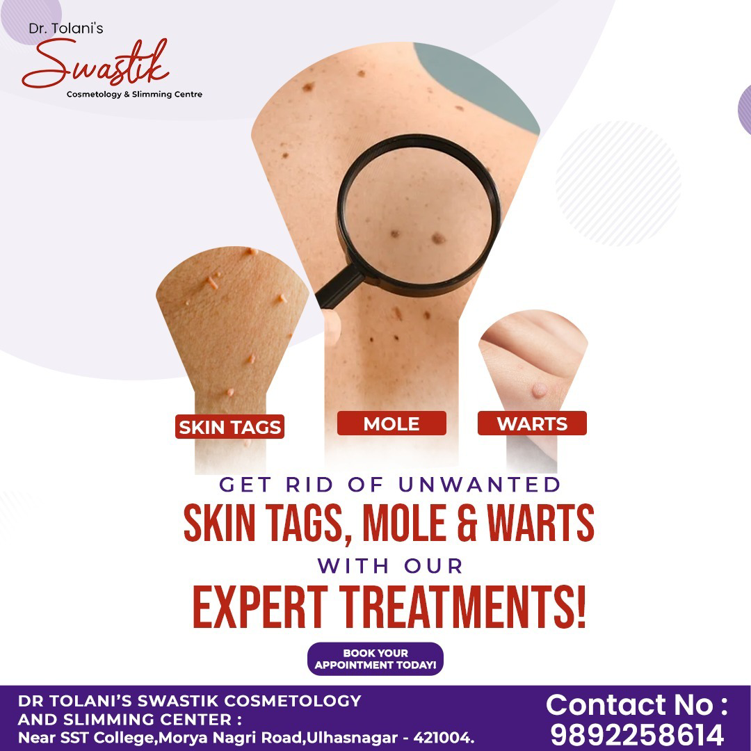 Best Acne Treatment in Ulhasnagar Kalyan Mumbai

B... main image