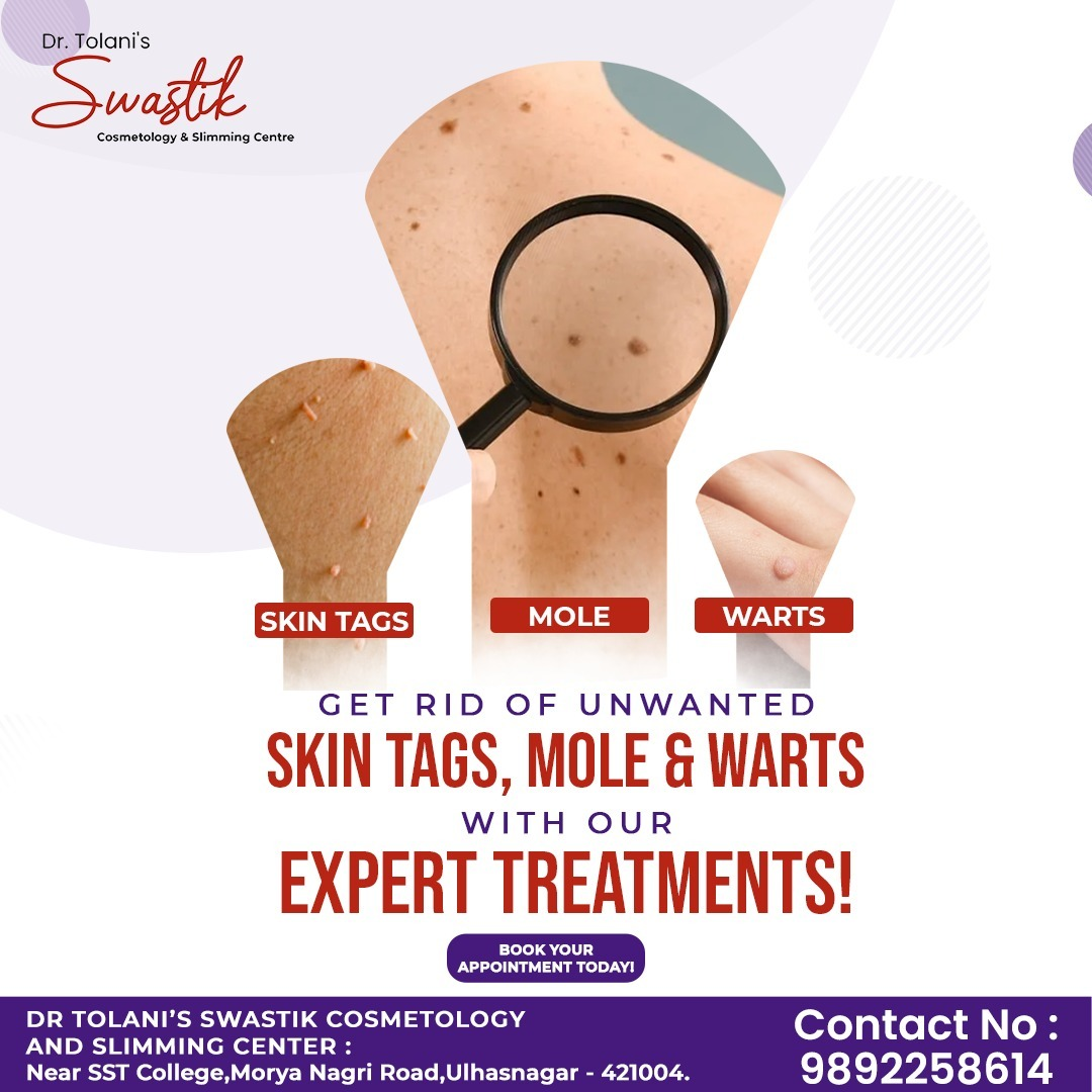 # Mole Removal  in Ulhasnagar 
# Skin Tags Removal... main image