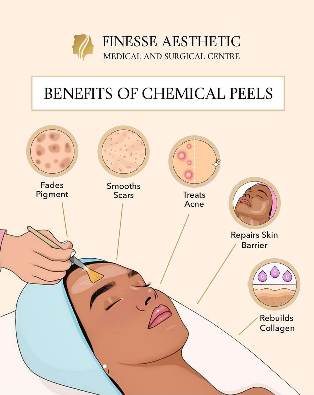 The Incredible Benefits of Chemical Peels for Your... main image