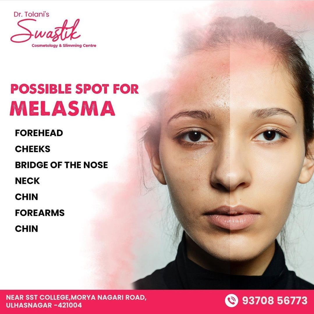 # Flawless Skin
# Clear Skin 
# Blemish free Skin
... main image