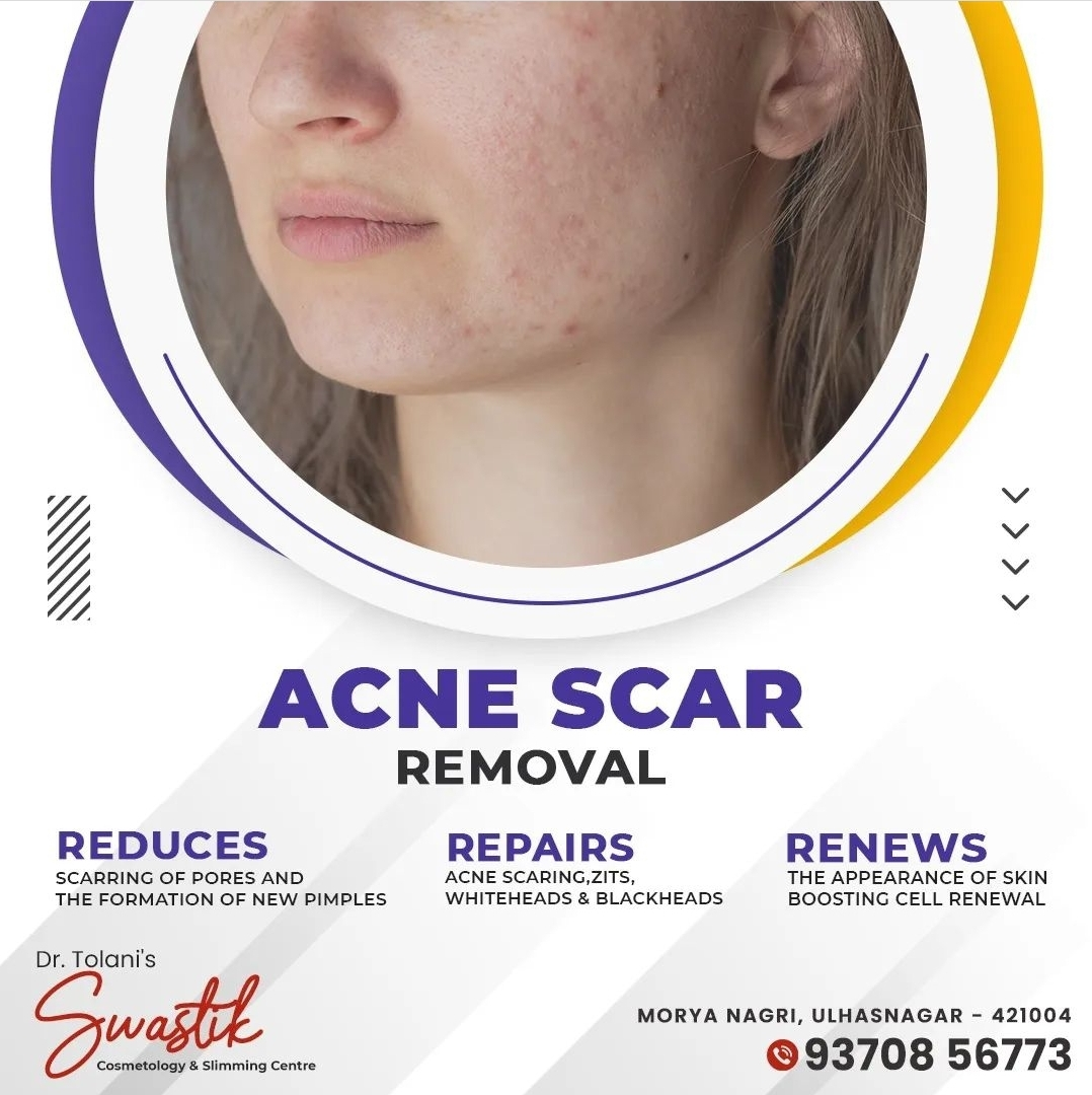 # Flawless Skin
# Clear Skin 
# Blemish free Skin
... main image