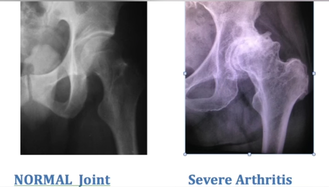 Physiotherapy clinic in Tambaram
Are you Looking f... main image