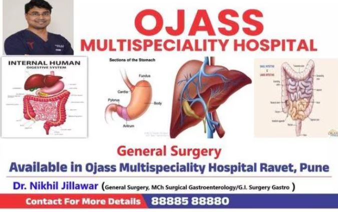 General and Laparoscopic Surgery in Pune For pa... main image