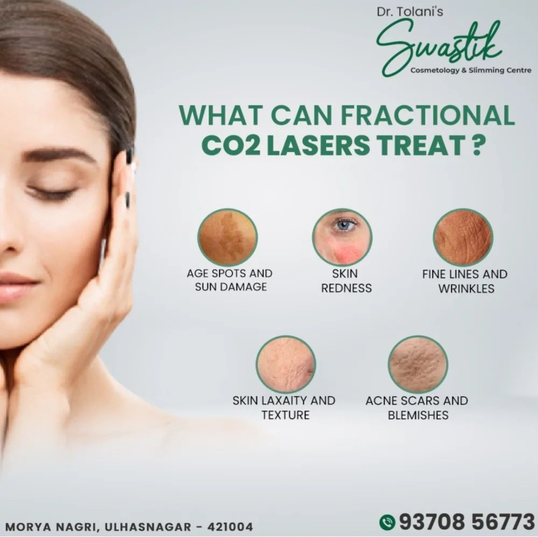 # Fine Lines And wrinkles Treatment 
# CO2 for ... main image