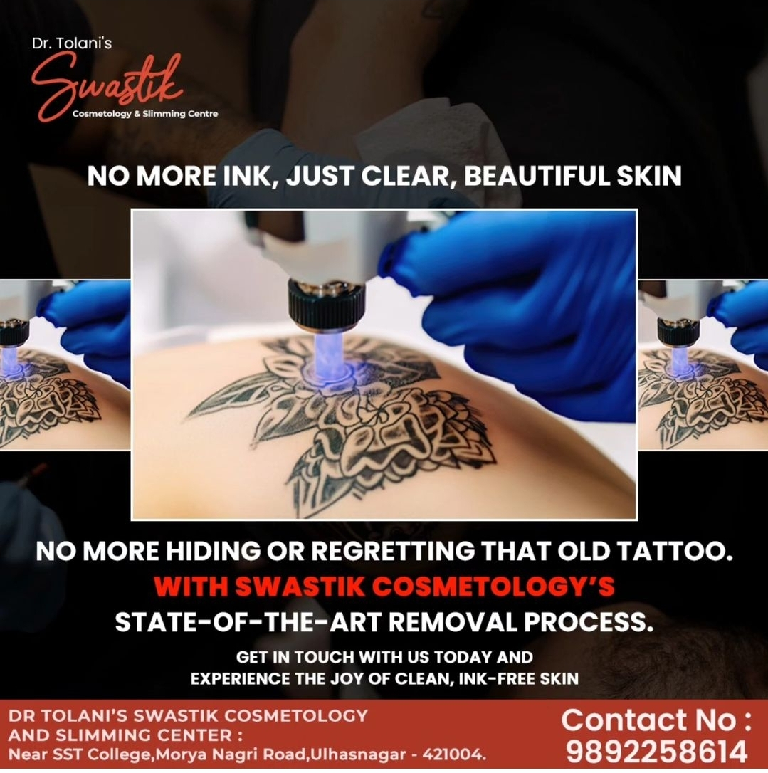 # Tattoo Removal in Ulhasnagar 
# Tattoo Removal i... main image