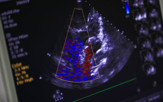 Echocardiogram Servi