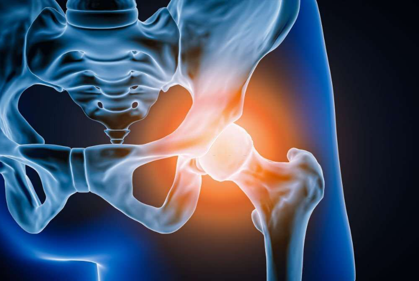 Bone Fracture Treatment in Ambattur: Swift and Eff... main image