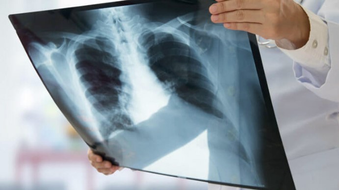 Digital X-Ray Services in Gurugram For accurate... main image