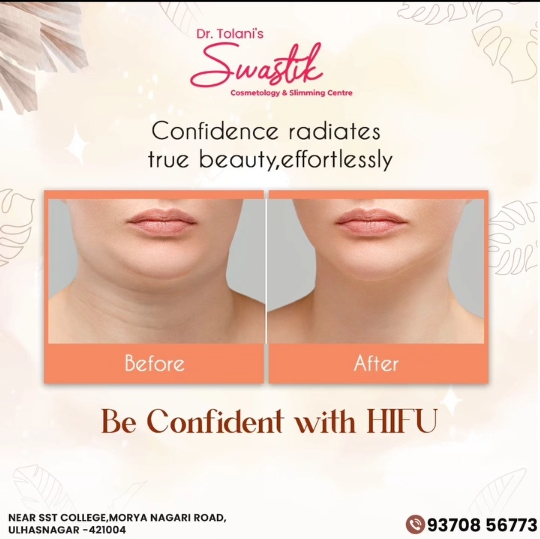 # HIFU
# Anti-aging 
# Remove Double chin
# Get Ri... main image