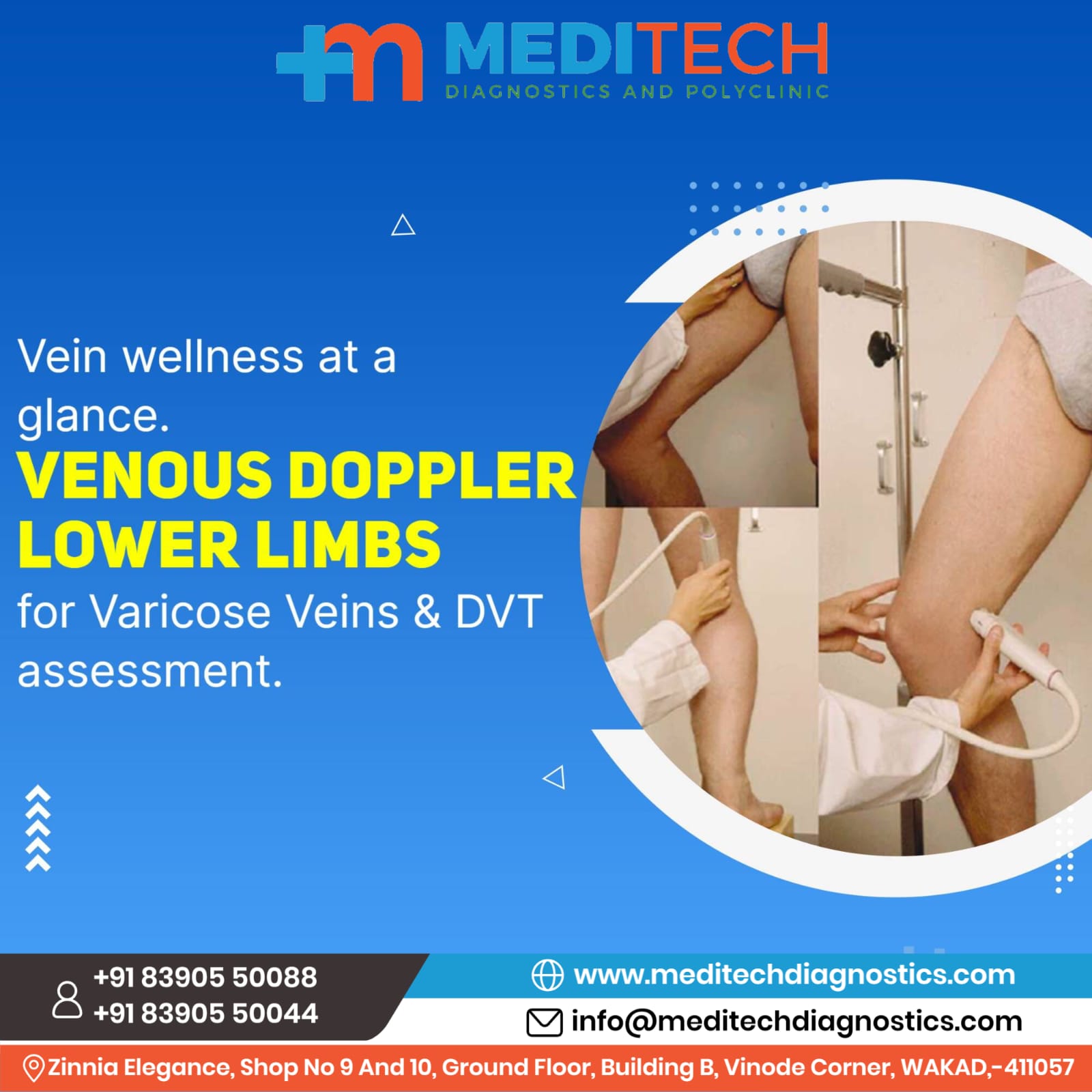 Are you suffering from leg swelling and leg pain? ... main image